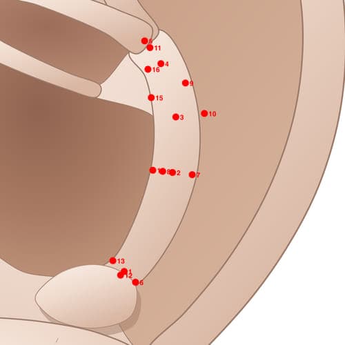 Location of acupuncture point AH02 (Thoracic Vertebrae)