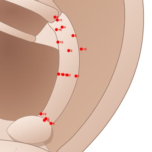 Location of acupuncture point AH07 Leixiebuwei (Intercostal Area)