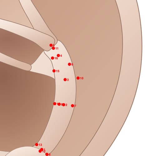 Location of acupuncture point AH10 Fuwai (External Abdomen)