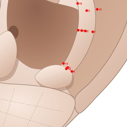 Location of acupuncture point AH13 (Neck)