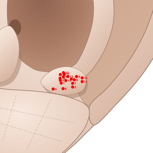 Location of acupuncture point AT09 (Neurasthenia Area)