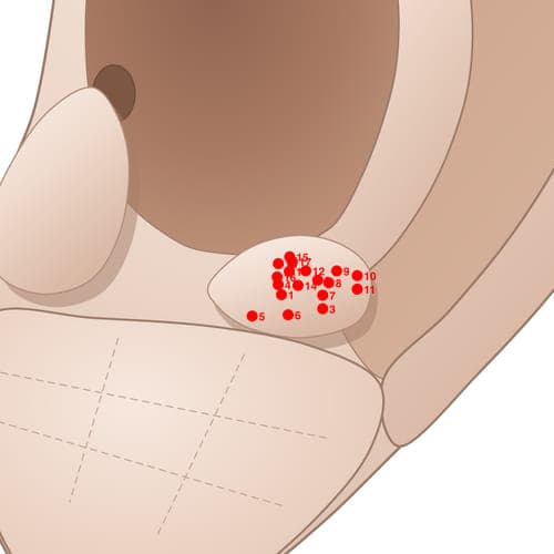 Location of acupuncture point AT16 (Epilepsy)