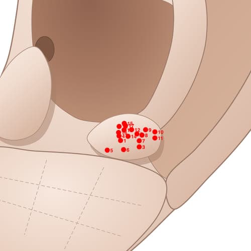 Location of acupuncture point AT17 (Exciting Point)