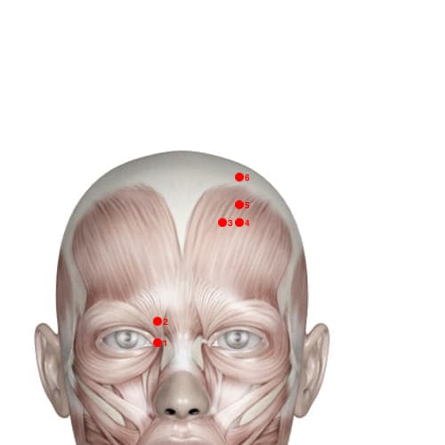 Location of acupuncture point BL03 (Eyebrow Ascension)