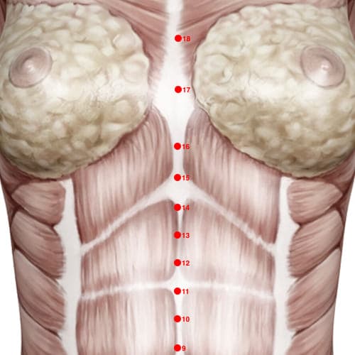 CV15 acupoint