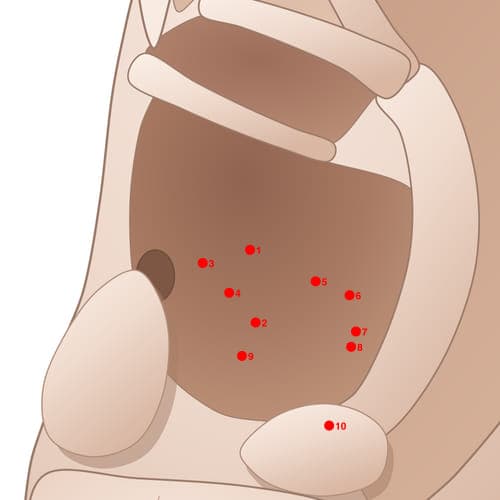 CVC01 acupoint