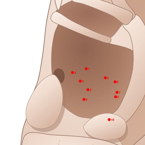 Location of acupuncture point CVC03 (Trachea)