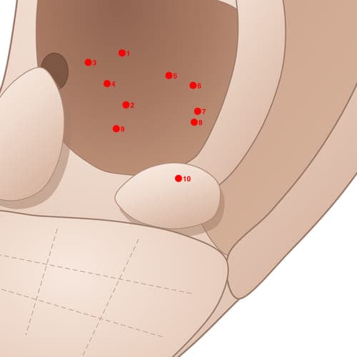 CVC10 acupoint