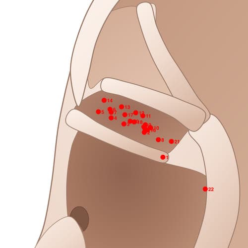 CYC03 acupoint