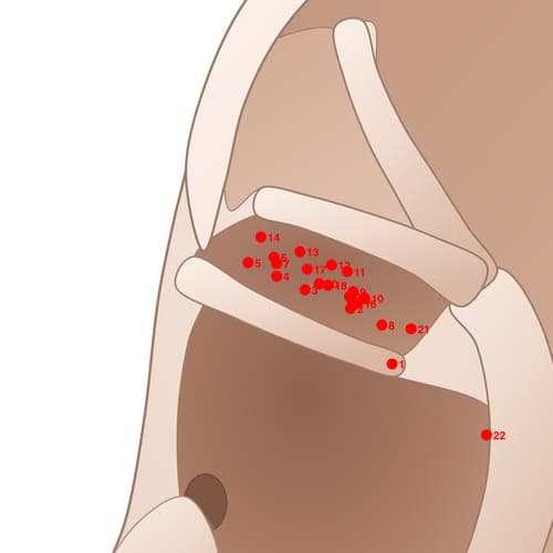 CYC04 acupoint