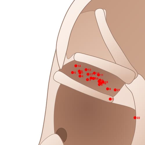 Location of acupuncture point CYC05 (Large Intestine)