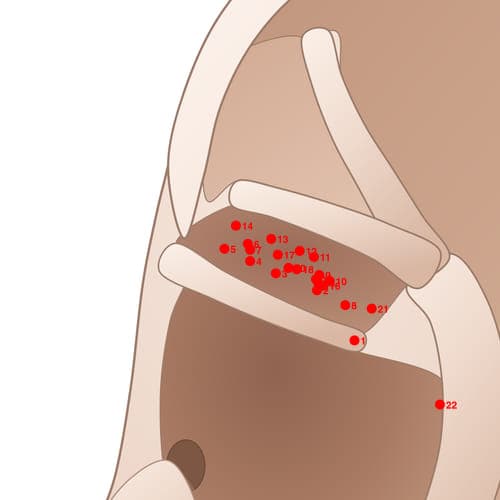 Location of acupuncture point CYC07 Lanwei (Appendix)