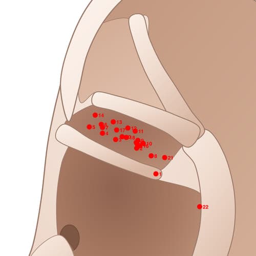 CYC12 acupoint