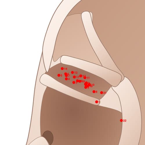 CYC13 acupoint