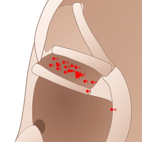 Location of acupuncture point CYC18 Duqi (Belly Button)