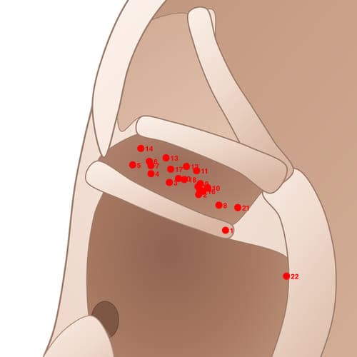 Location of acupuncture point CYC20 Zuidian (Drunk Point)