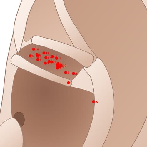 CYC21 acupoint
