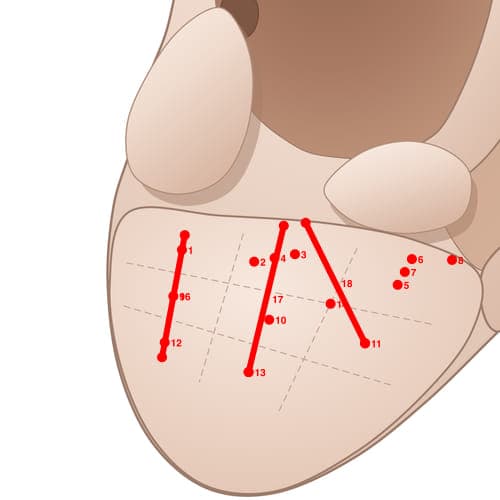 Location of acupuncture point EL01 (Tooth)