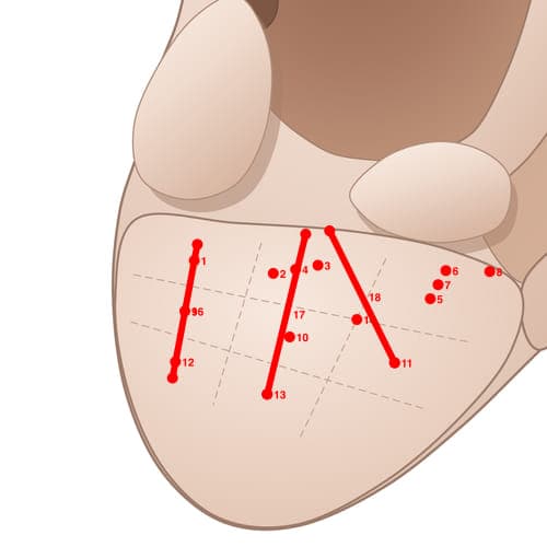 Location of acupuncture point EL02 (Lower Palate)