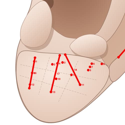 Location of acupuncture point EL03 (Upper Palate)