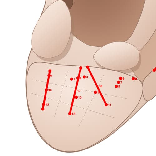Location of acupuncture point EL04 (Tongue)