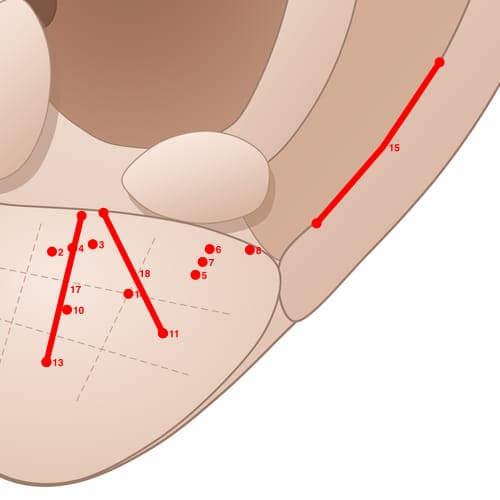 Location of acupuncture point EL08 Zhichi (Wisdom Teeth)
