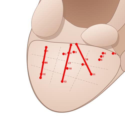Location of acupuncture point EL09 (Neurasthenia Point)