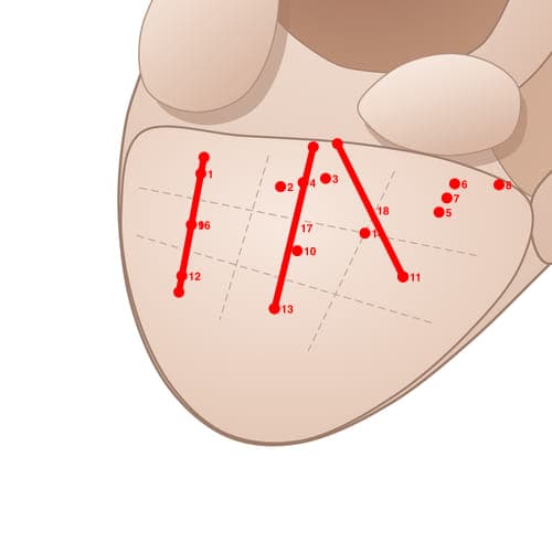 Location of acupuncture point EL12 (Anxious Point)