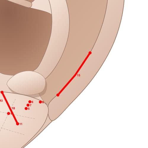 Location of acupuncture point EL15 (Tumor Specific Area 1)