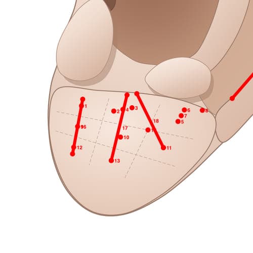 Location of acupuncture point EL16 (Groove of Hypotension)