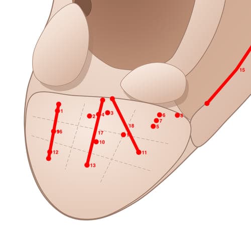 Location of acupuncture point EL18 (Groove of Tinnitus)