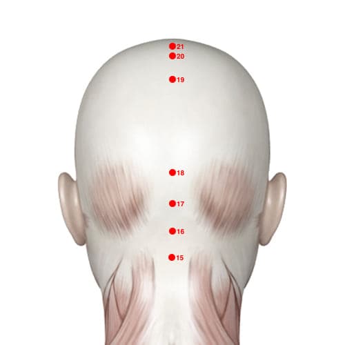 Location of acupuncture point GV18 (Unyielding Space)
