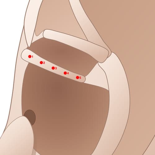 Location of acupuncture point HCS05 Bimen (Cardia)
