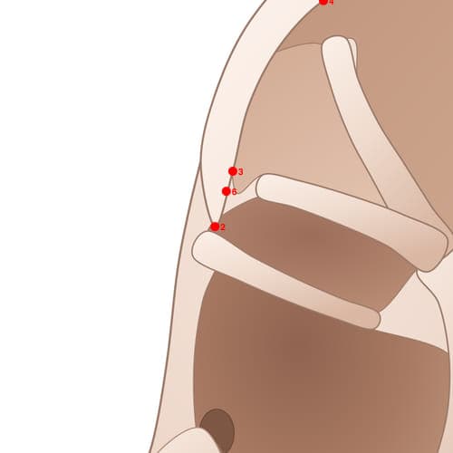 Location of acupuncture point HX02 Zhichang (Rectum)