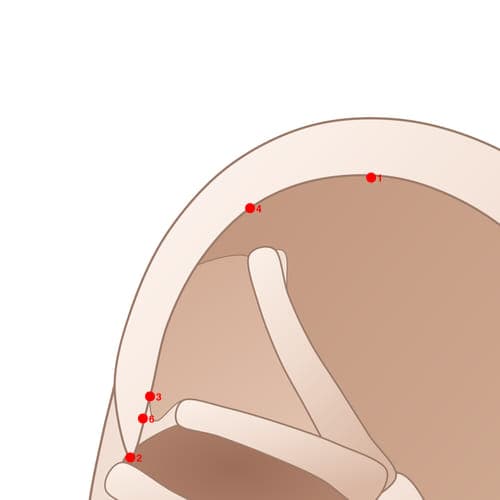 Location of acupuncture point HX04 (External Genital)