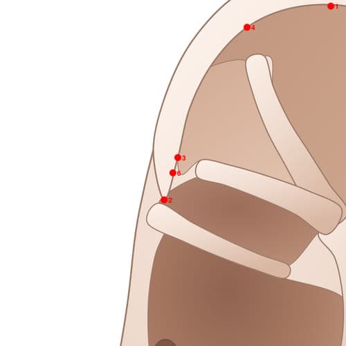 Location of acupuncture point HX06 (Anus)