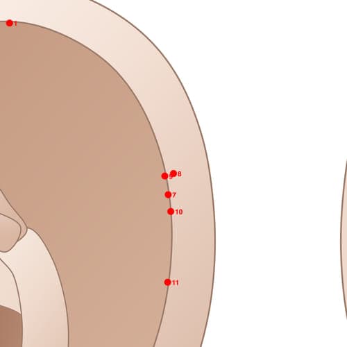 Location of acupuncture point HX08 Zhenxiaoshenjingdian (Lesser Occipital Nerve)