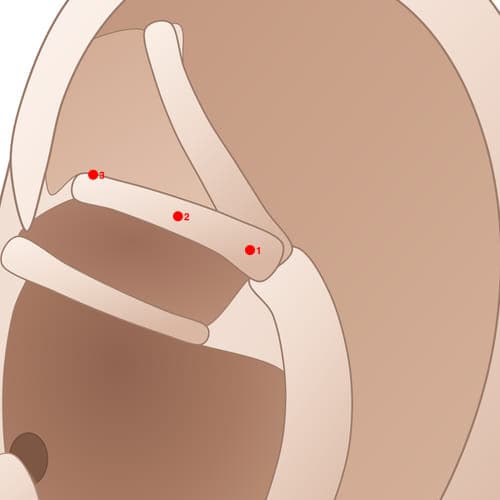 Location of acupuncture point IAC01 Tun (Hip)