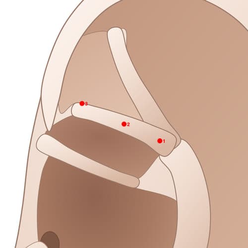 Location of acupuncture point IAC02 Zuogushenjing (Sciatic Nerve)