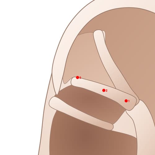 IAC03 acupoint
