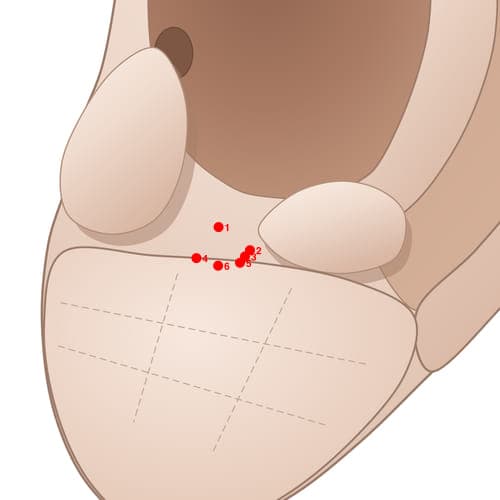 Location of acupuncture point IN02 (Ovary)