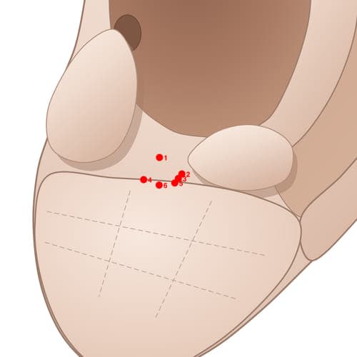 Location of acupuncture point IN03 (Gonadotropin)