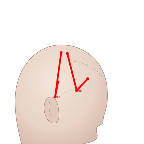 MS06 acupoint