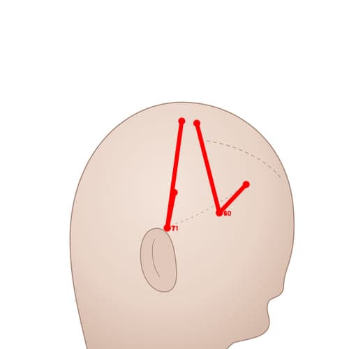 MS07 acupoint