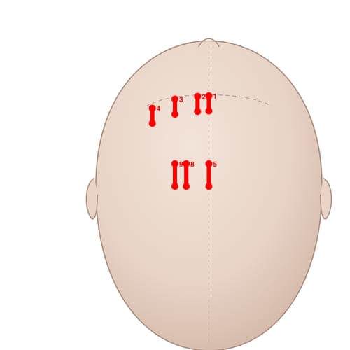 MS09 acupoint