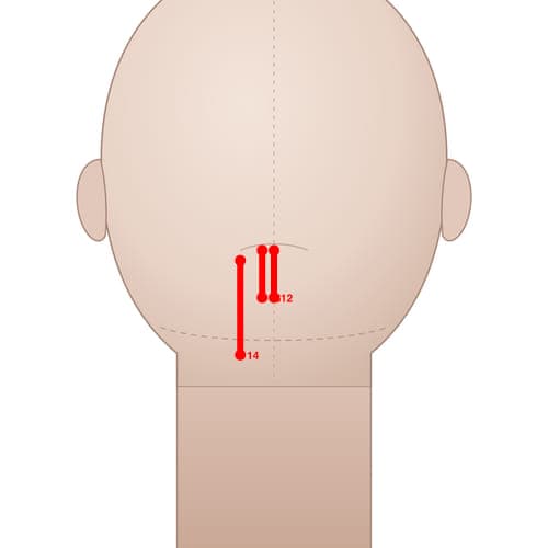 MS12 acupoint