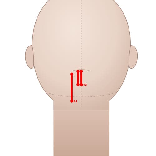 MS13 acupoint