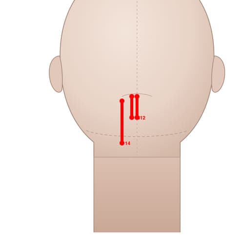 Location of acupuncture point MS14 (Lower-Lateral Line of Occiput)