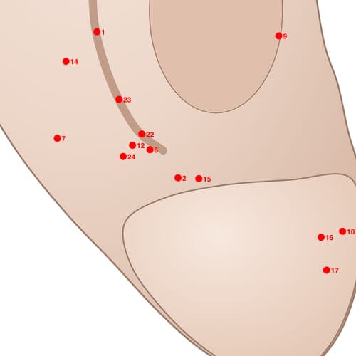 Location of acupuncture point POS02 (Groove of Brain Posterior)