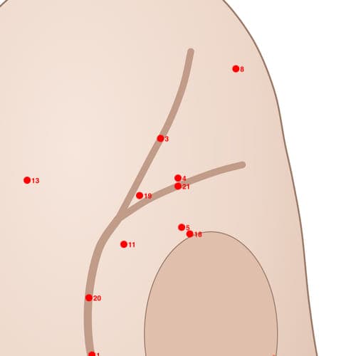 Location of acupuncture point POS04 (Groove of Sciatic Posterior)